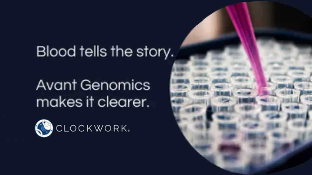 Avant featured in ClockWork Innovator Spotlight